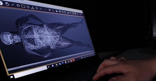 Full-body Forensic  X-Ray Imaging